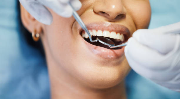 Best Broken or Cracked Tooth Emergency Dentist in Fredericksburg, VA