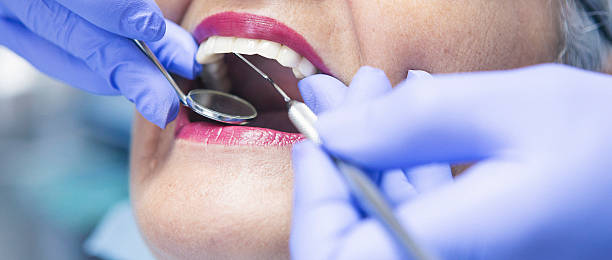 Best Emergency Dental Services for Seniors in Fredericksburg, VA